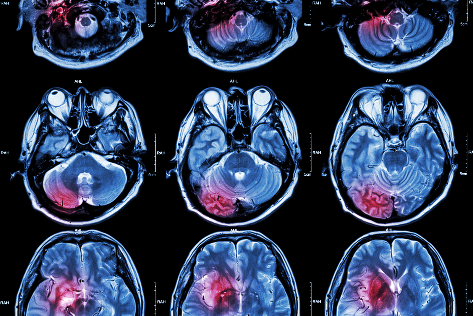 the-differences-between-imaging-studies-used-to-diagnose-brain-injuries