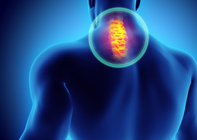 Check The Neck After A Brain Injury - Elizabeth Sandel, M.D.