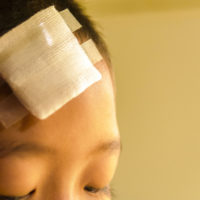 Close up of child with bandage over head wound