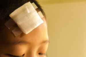 Close up of child with bandage over head wound