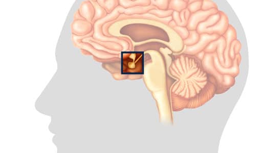 pituitary / brain