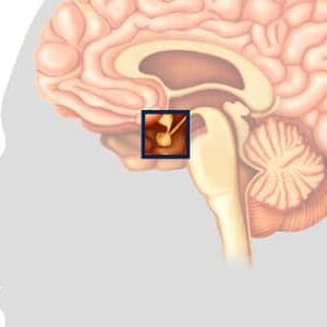 pituitary / brain